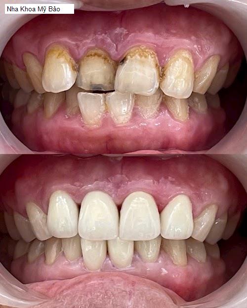 Hình ảnh Nha Khoa Mỹ Bảo