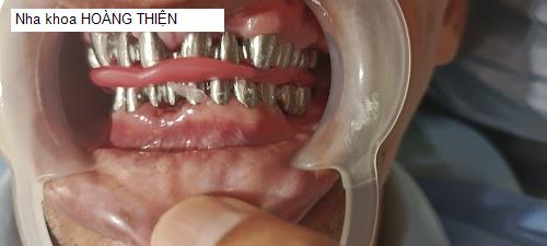 Hình ảnh Nha khoa HOÀNG THIỆN
