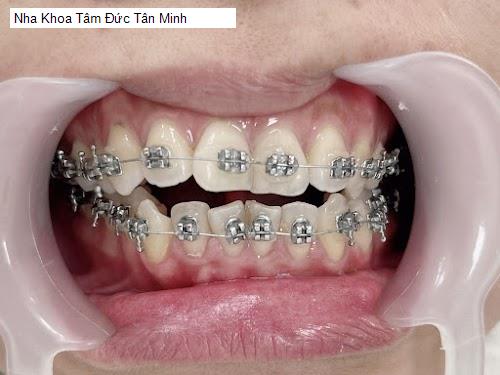 Hình ảnh Nha Khoa Tâm Đức Tân Minh